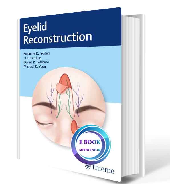 دانلود کتابEyelid Reconstruction 2020(ORIGINAL PDF)  